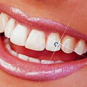 Geralmente, o piercing dental é colado nos dentes incisivos